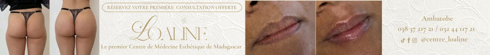 no comment - Loaline